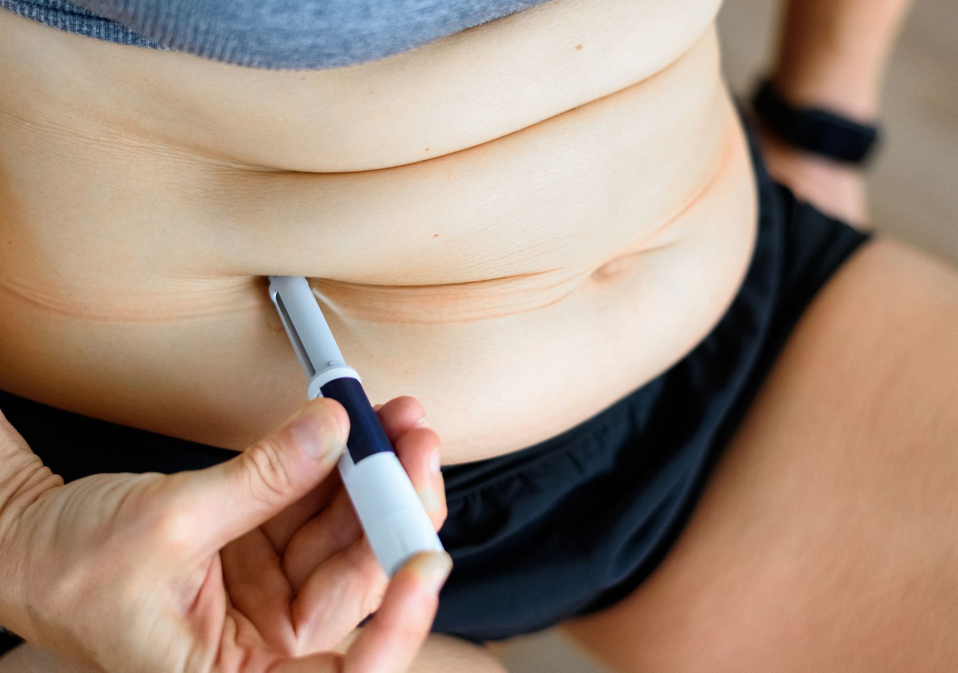 Frau injiziert sich eine Abnehmspritze in den Bauch – Beispiel für Anwendung unter ärztlicher Aufsicht